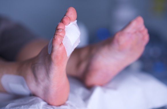Cryosurgery 3