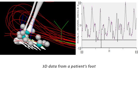 Complex foot motion