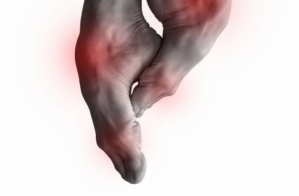 Joint Hypermobility Syndrome (BJHS)